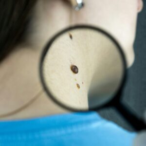 Dermatologia em Medicina Geral e Familiar