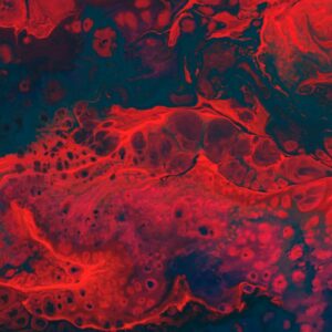 Dislipidemia: Abordagem 360